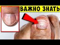 Почему появились Полоски на Ногтях ! Откуда они и Что делать...