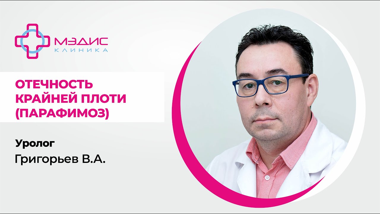 116.33. Отечность крайне плоти (парафимоз) - лечение. Григорьев Валерий Анатольевич, уролог.