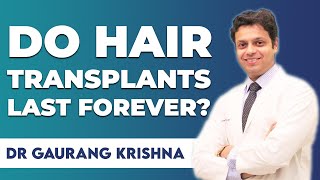 How long do Transplanted Hair last | Is Hair Transplant Permanent?| Medlinks Hair Transplants, Delhi