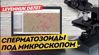 Лабораторный микроскоп LEVENHUK D870T С КАМЕРОЙ | Обзор и тест