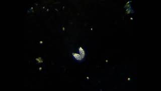 Ciliate's conjugation