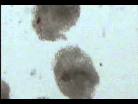 Follicular Fluid Follicular Fluid