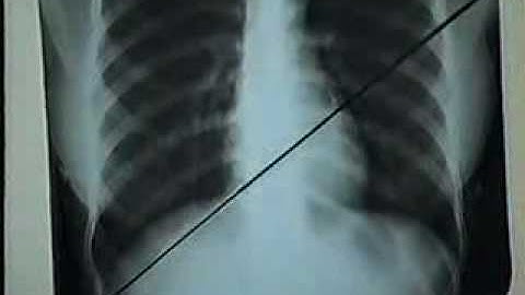 01 CachXemPhim[bacsihoasung.wordpress.com].wmv