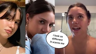 Kenzie Ziegler Confirms Nose Job