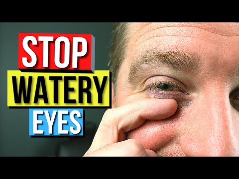 Video: Kaip sustabdyti pernelyg didelį akių ašarojimą?