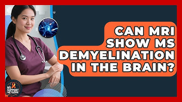 Can MRI Show MS Demyelination In The Brain? - MS Support Network
