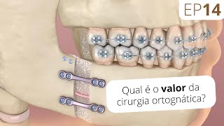 EP14 Qual o valor da cirurgia ortognática? I Instituto Maxiloface