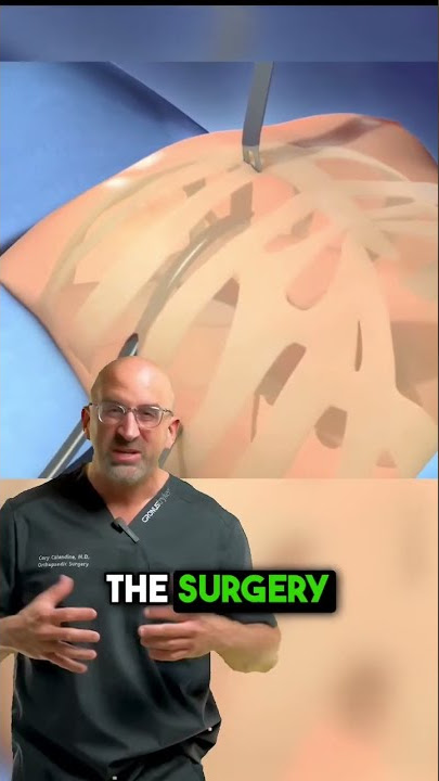 Most PAINFUL Minimally-Invasive Surgery 😫 #shorts #pectusexcavatum