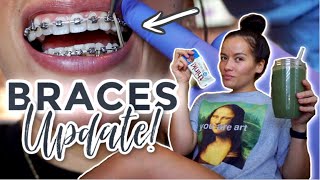 BRACES UPDATE VLOG | Getting ELASTICS! + Healthy Smoothie for SORE TEETH!