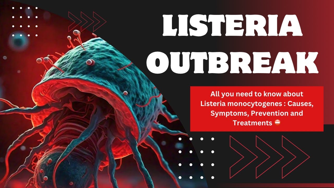 LISTERIA OUTBREAK 2024 Listeria Monocytogenes and Symptoms YouTube