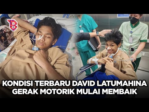 Kondisi terbaru David Ozora korban Mario Dandi, fisik masih rentan perlu terapi hingga 1 tahun