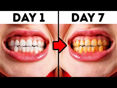 Video: 10 sätt att inte tugga på tandläkaren