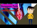 Quiz tentang Gangguan Sistem Gerak