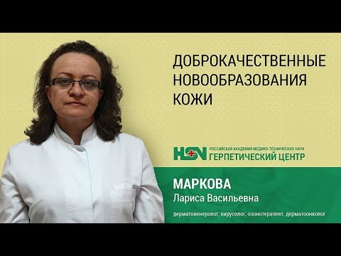 Доброкачественные новообразования кожи