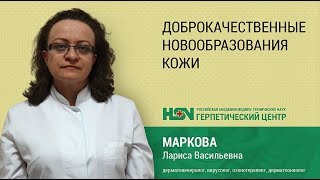 Доброкачественные новообразования кожи