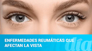 ¿Afecta la esclerodermia a los ojos?