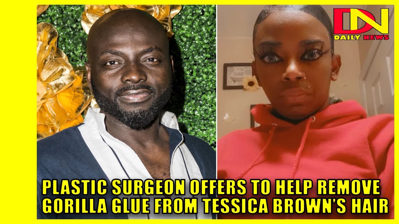 Plastic surgeon offers to help remove Gorilla Glue from Tessica ...