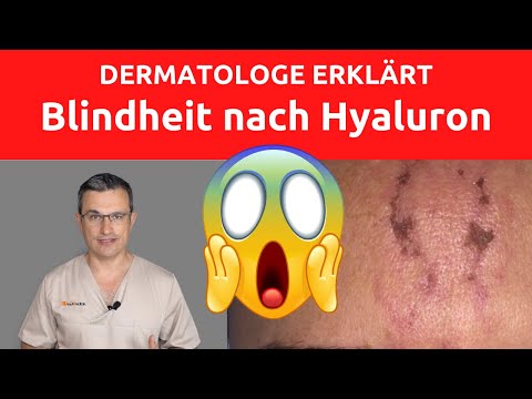 Video: Hyaluronsäure: Was Sie Wissen Müssen Und Welche Mittel Sie Wählen Müssen