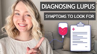 DIAGNOSING LUPUS | Symptoms and Tests