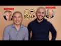 Scalp Micropigmentation is the #1 Solution for Hair Loss