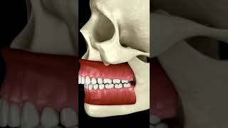 The Difference Between Overbite and Underbite
