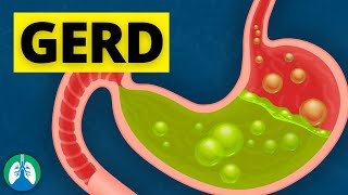 What Causes GERD?