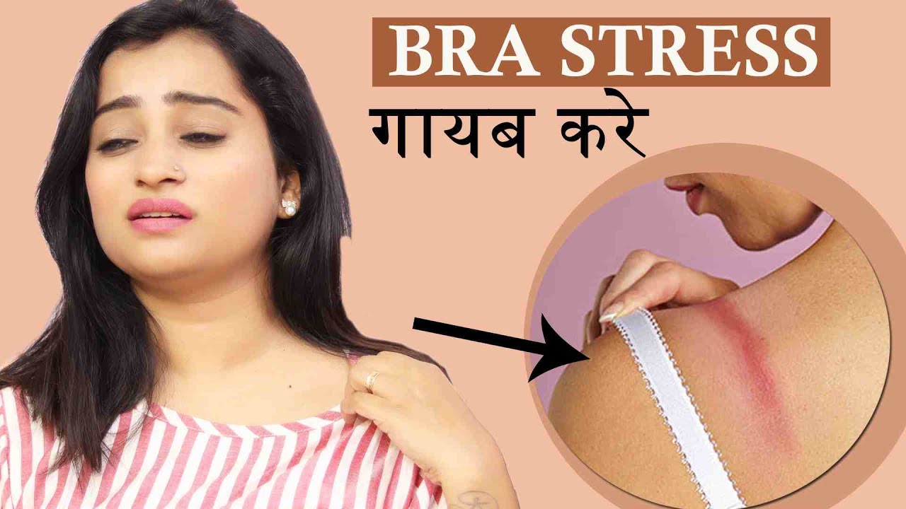 BRA STRESS - Reduce itching, irritation, & inflammation Because of