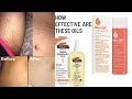 How to get rid of stretch marks #bio oil stretch marks,#reaction