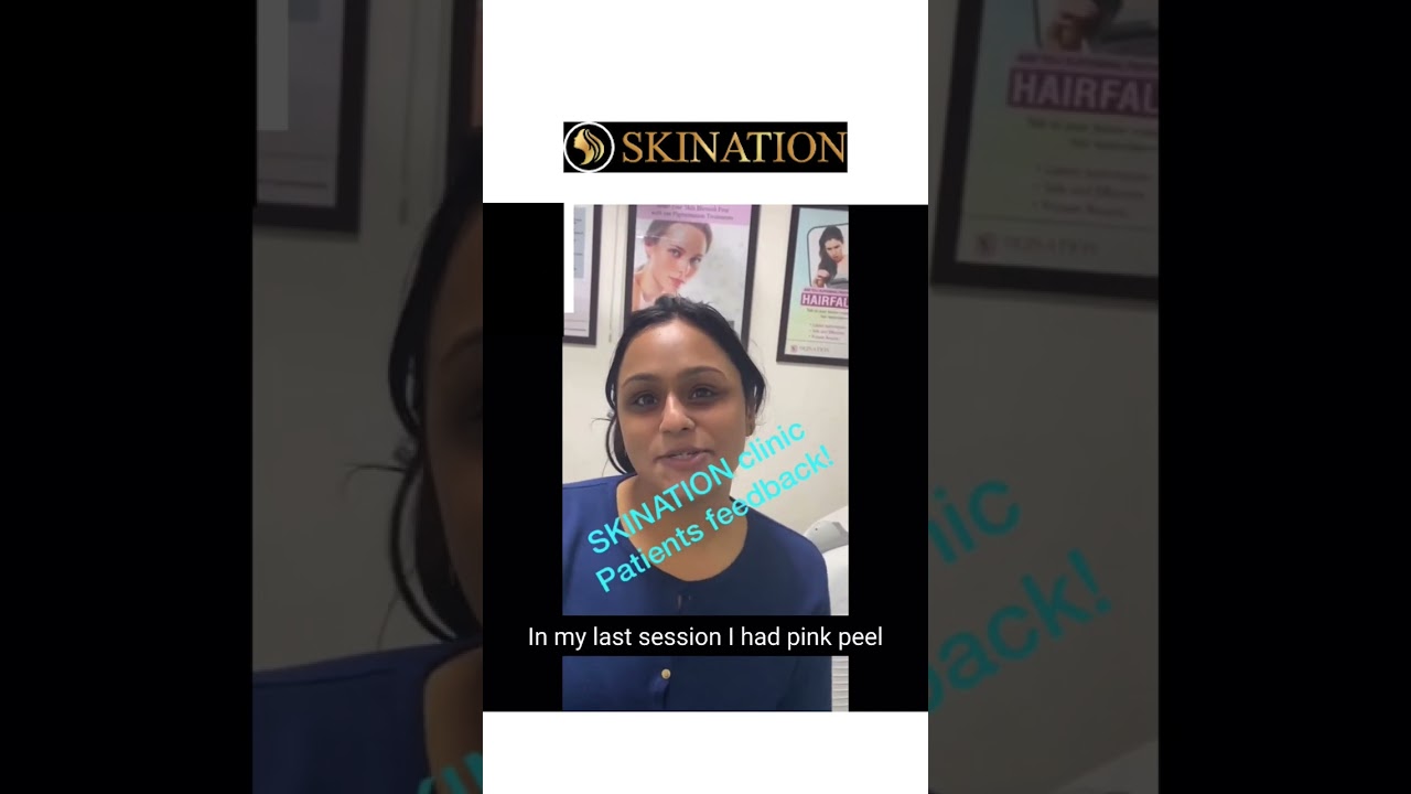 Acne treatment peel and Q Switch laser