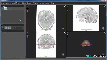 Exporting Images using ImFusion Suite