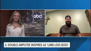 News Interview- Limb Loss Boss Internet Famous Amputee Followers? Millions. Legs? None.