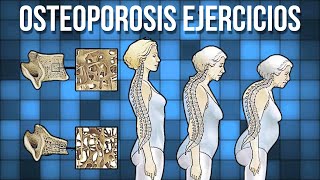 Rutina de EJERCICIOS para la OSTEOPOROSIS