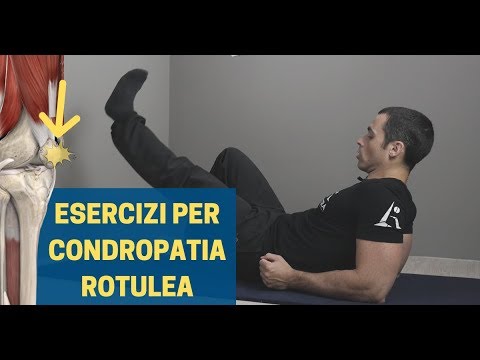 Video: Esercizi Al Ginocchio Del Corridore: Trattamento Della Sindrome Patello-femorale