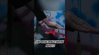 Bu Kadinin Eli̇ Deli̇klerle Kaplanir