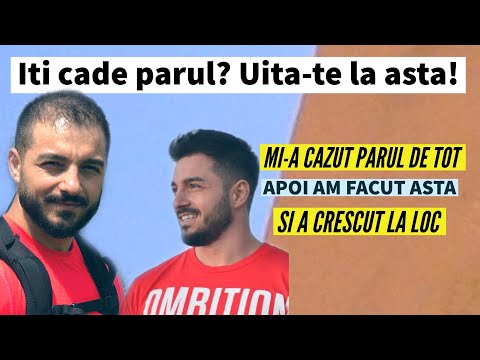 MI-A CRESCUT PARUL DUPA CE AM FACUT ASTA - Am fost chel, dar am urmat metoda aceasta si a crescut