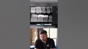 How AI Transforms the Dental X-ray Process #ai #dentist #technology