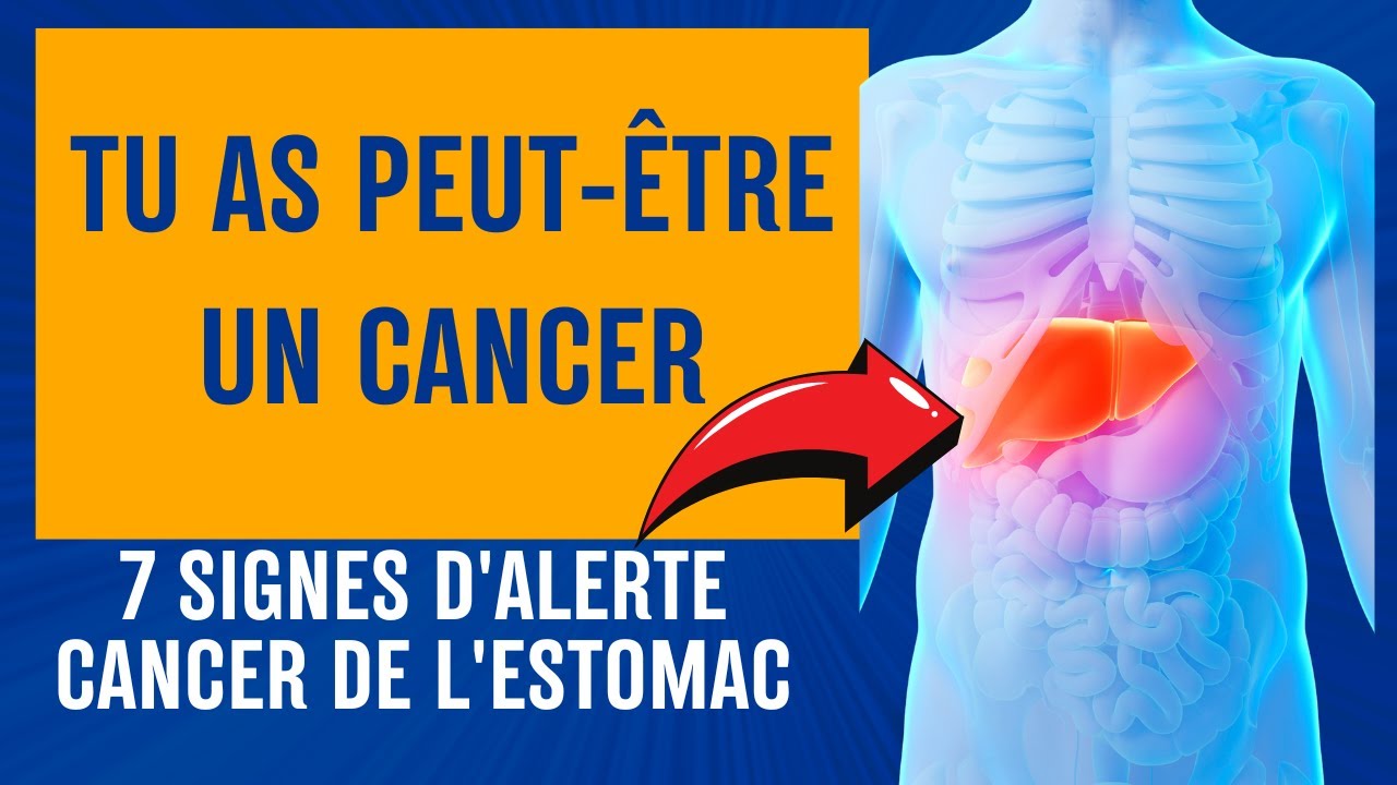 🚨 7 SYMPTÔMES SILENCIEUX DU CANCER DE L'ESTOMAC que vous ne devez — free download