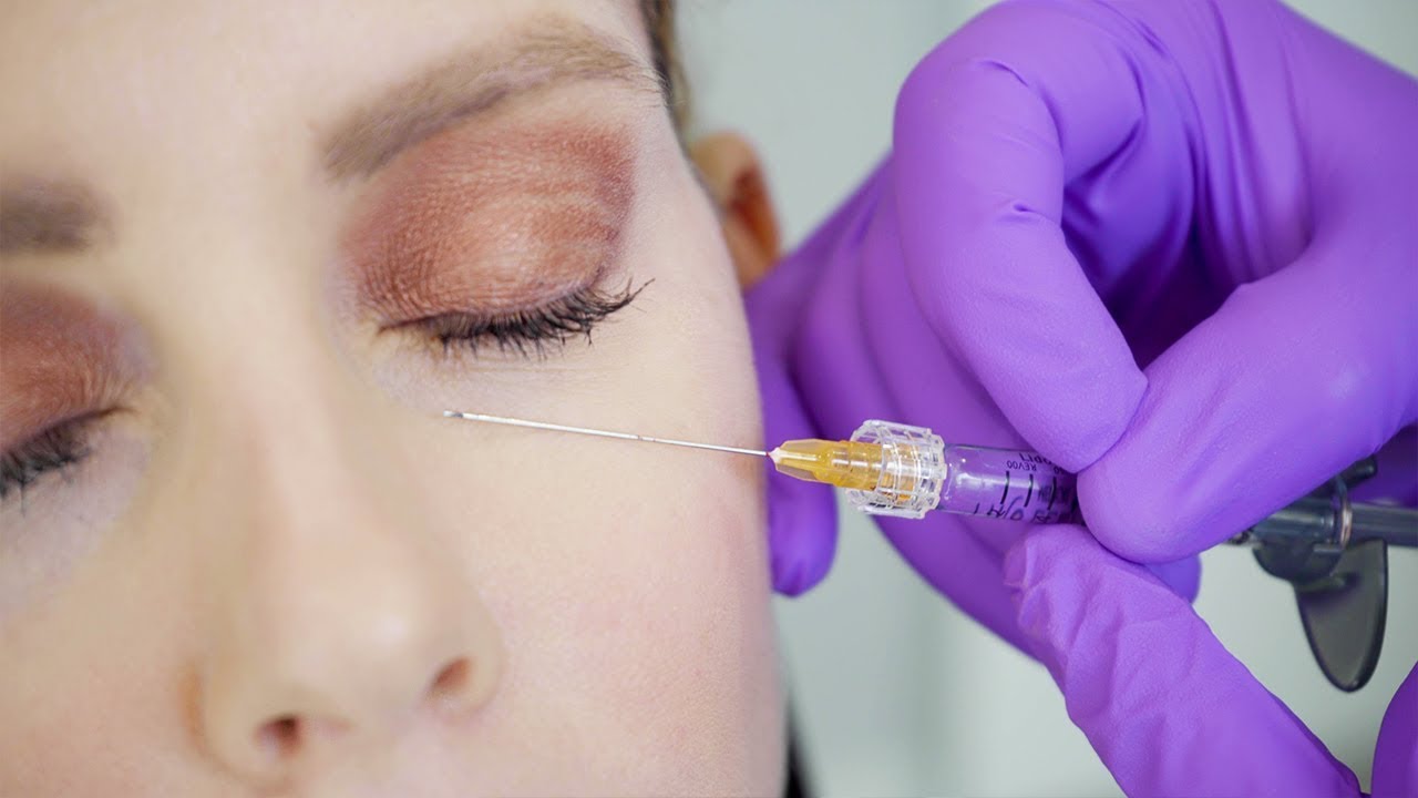 Under Eye Hollows Correction with Revanesse Versa Filler by Dr. Kian