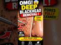 Nose Blackheads &amp; Sebum Extraction ASMR. #nose