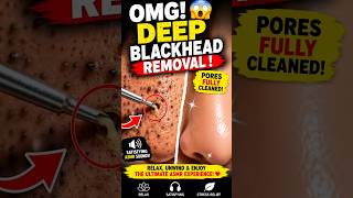 Nose Blackheads & Sebum Extraction ASMR. #nose