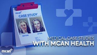 Plastic Surgery Turkey Mcan Health Medical Case Studies