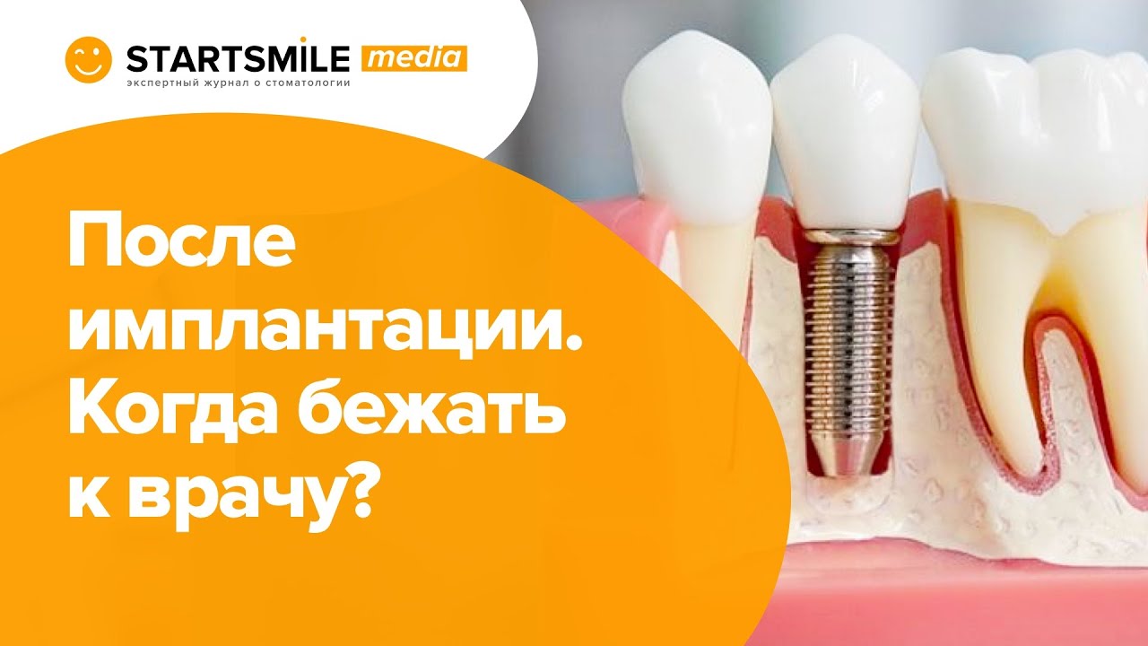 Отек после имплантации, что делать? - YouTube