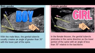 Full Baby Gender Prediction: Is The Nub Theory Accurate At Predicting Sex News