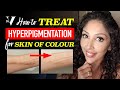 DOCTOR V's HOW TO TREAT HYPERPIGMENTATION for SKIN OF COLOUR | BROWN/ DARK SKINCARE | DR V soc