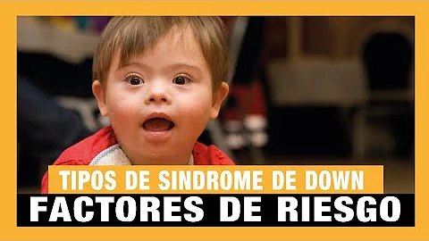 ¿Cuál es el mayor factor de riesgo conocido del síndrome de Down?