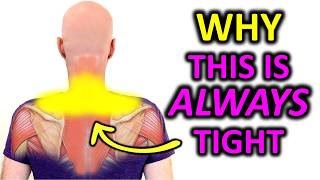 Why Your Neck and Shoulders Are Always Tight