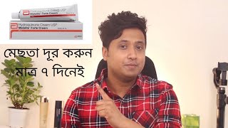 মেছতা দূর করুন মাত্র ৭ দিনেই   Mesta Cream   মেছতা কেন হয়