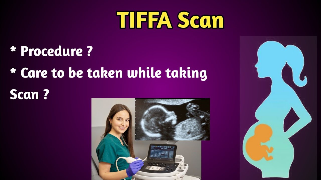 breech presentation in tiffa scan