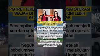 Potret terbaru iis dahlia usai oplas