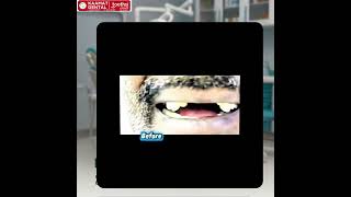 Teeth Transformation You Won’t Believe! | Before vs After | Kaamat Dental #smilegoals #dentalclinic